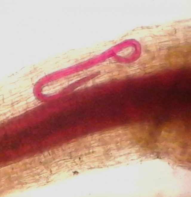 nematoide