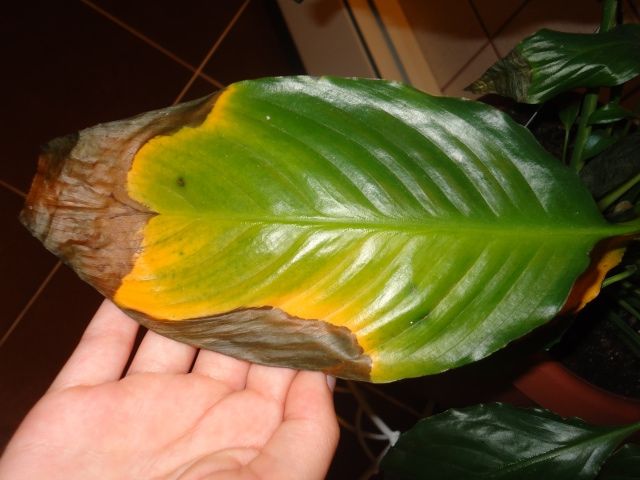 queimaduras